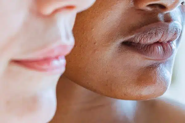 Lutter efficacement contre les imperfections de la peau grâce à ces méthodes naturelles
